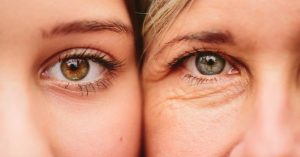 Cách cải thiện hiệu quả quầng thâm ở vùng mắt